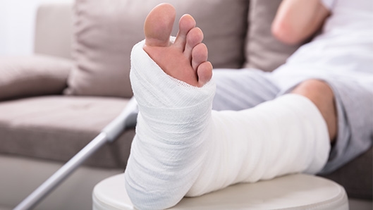 foot in cast